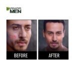 Buy Garnier Acnofight Face Wash 100G Online at Classic Medico