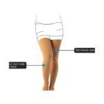 Buy Vissco Vericose Vein Stocking Xl Online at Classic Medico