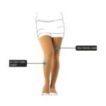 Buy Vissco Vericose Vein Stocking S Online at Classic Medico