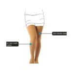 Buy Vissco Mc Stocking S Online at Classic Medico