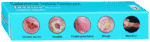 Idoxine Ointment 10G - View 4