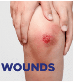 Soframycin Skin Cream 30G - View 8