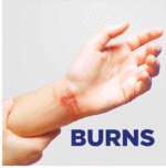 Soframycin Skin Cream 30G - View 7