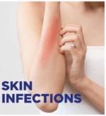 Soframycin Skin Cream 30G - View 6